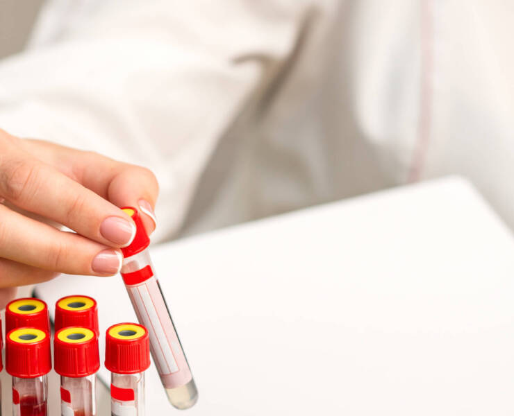 Hand of lab technician or nurse takes empty blood test tube from rack in the research laboratory
