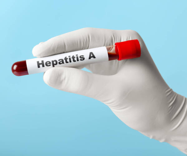 Scientist holding tube with blood sample and label Hepatitis A on light blue background, closeup