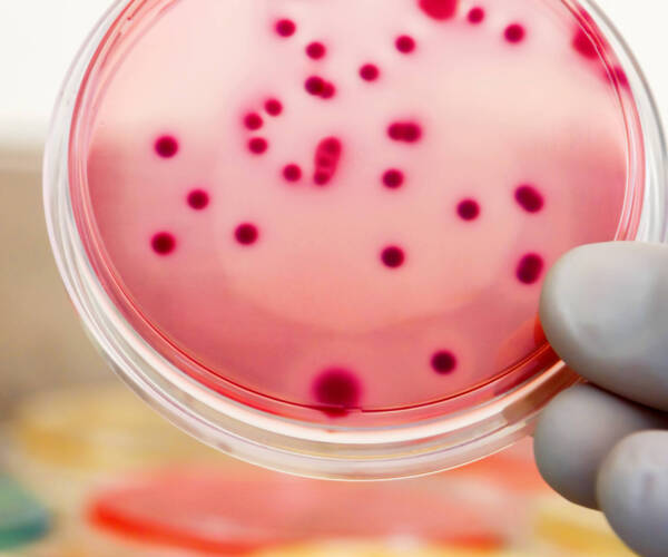 Bacterial colonies culture on Differential and Selective media. Biotechnology, health.