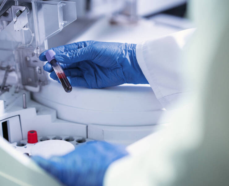 Hematología