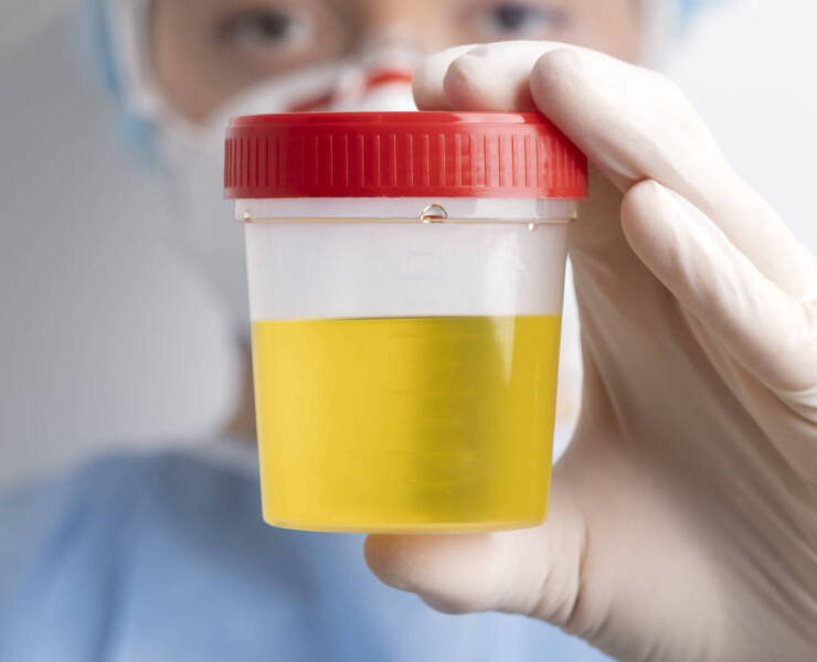 Urología
